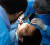 Dantų šaknų kanalų gydymas, ką reikia žinoti?