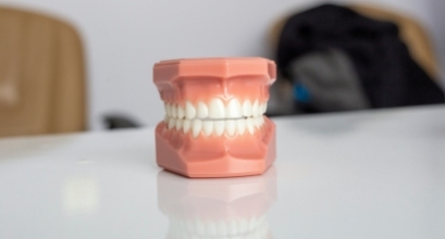 Kas yra 3D dantų nuotrauka ir kada ji reikalinga?